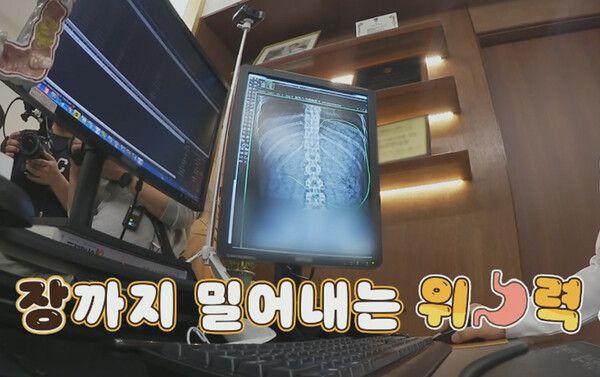 장까지 밀어내는 히밥의 위 상태 /사진='토요일은 밥이 좋아'