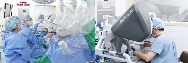 간이식_공여자_로봇수술(사진)