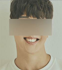 화면 캡처 2024-05-12 101446.png [혐오] 강아지 눈 파열, 야탑 학대남