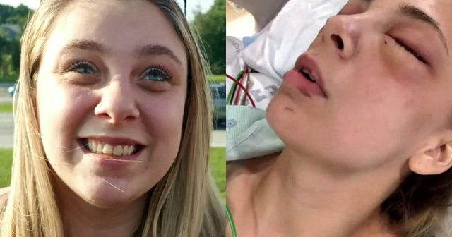 image.png “눈 뽑아야 한...