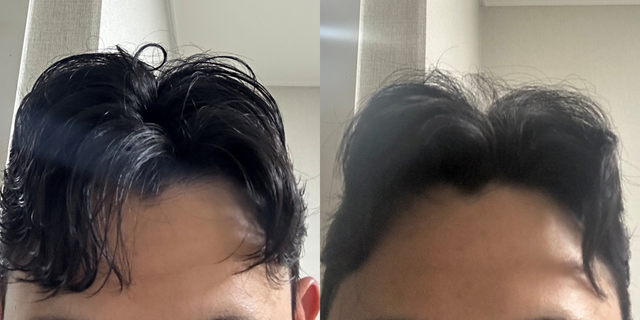 그림2.png 본인 머리 평가좀