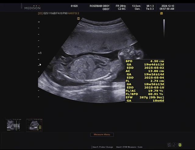 IMG_5433.jpeg 이 시국에.... 애국추 가능!?