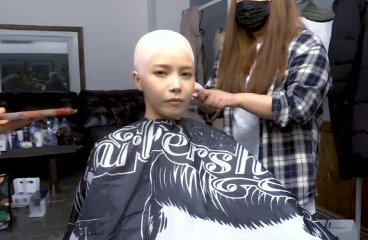 최근 탈모를 앓고 있다고 고백한 솔라(기사의 이해를 돕기위한 사진) / 이데일리