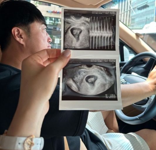 둘째 소식을 전한 장동민 - 주우진 부부 / SNS 캡쳐