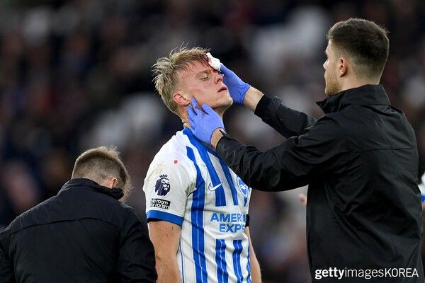 ▲21일 영국 런던의 런던 스타디움에서 열린 웨스트햄 유나이티드 FC와 브라이튼 앤 호브 알비온 FC의 프리미어리그 경기 중 부상을 당한 얀 폴 반 헤케 (사진=gettyimagesKOREA)