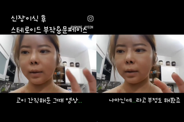 ▲박지연 (사진=박지연 SNS)