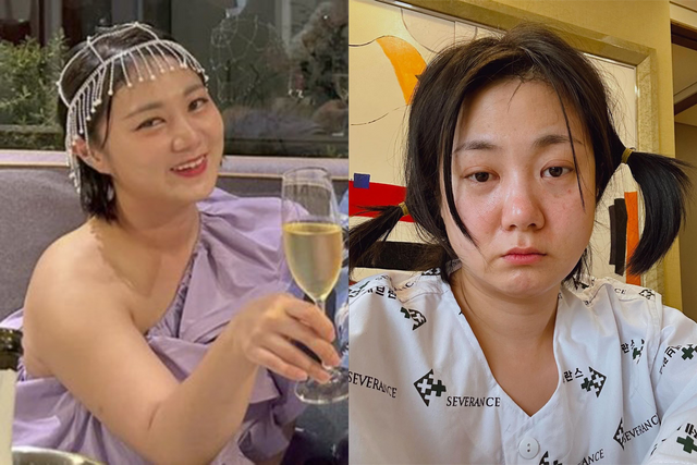 ▲박나래 (사진=박나래 SNS)