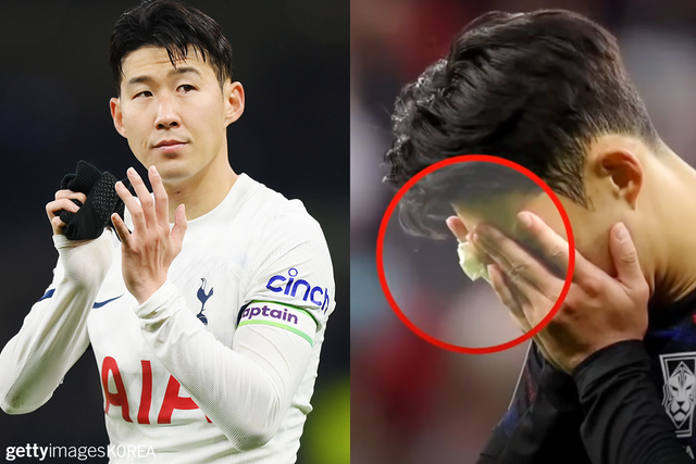 ▲손흥민 (사진=KBS news,&nbsp;GettyimagesKOREA)