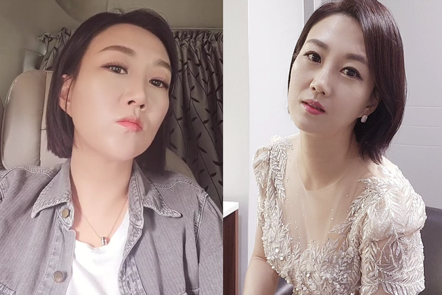 ▲장윤정 (사진=SNS)