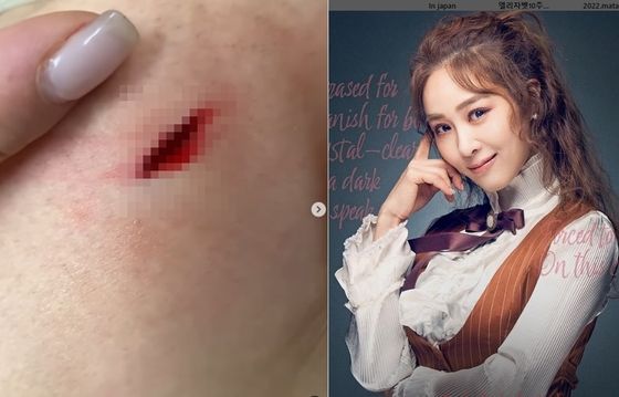 옥주현이 공연 중 다친 부위를 공개했다./ 옥주현 인스타그램