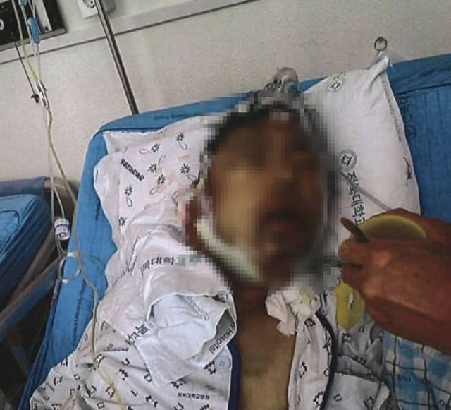 10대들에게 묻지마 폭행 사건을 당한 A씨의 모습 / 출처 - A씨 측 변호인