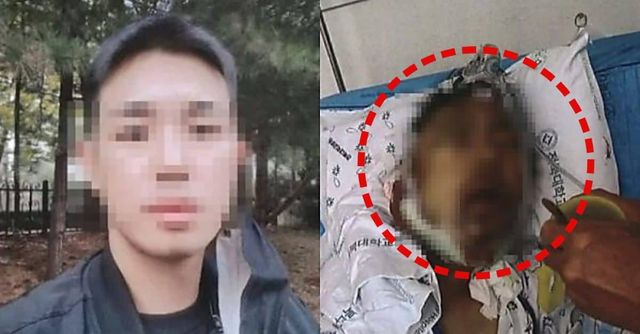 10대들에게 묻지마 폭행 사건을 당한 A씨의 모습 / 출처 - A씨 측 변호인