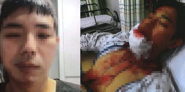 10대들에게 묻지마 폭행 사건을 당한 A씨의 모습 / 출처 - A씨 측 변호인