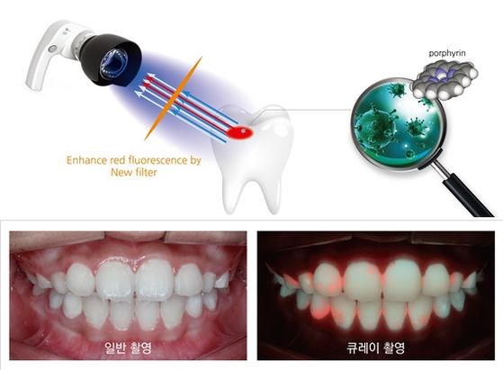 정량광형광기(Q-ray) 검사법 /(주)아이오바이오