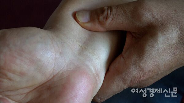 장 목사는 중국에서 선교하다가 5년간 수감 생활을 했다. 그의 손목에는 수갑 자국이 남아있다. /장세곤 기자