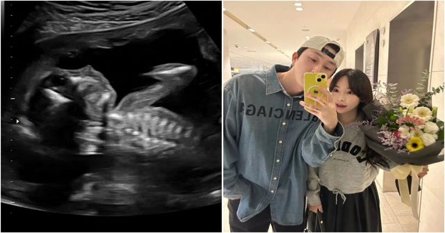 사진 출처: 슬리피 인스타그램