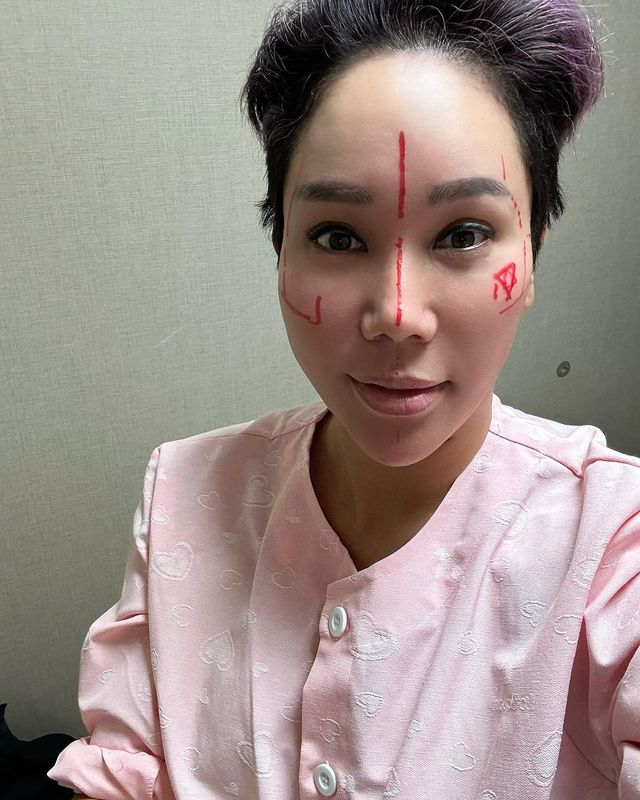 이미지 출처 = 김송 인스타그램