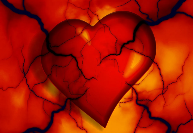 사진=픽사베이(기사와 관계없는 사진)