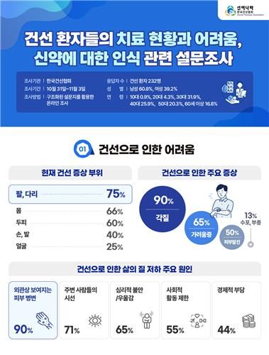 삶의질 떨어뜨리는 은백색 각질 '건선'…