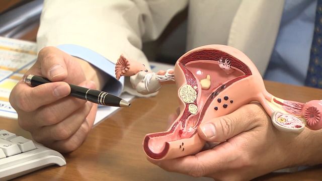 '연간 8회 이하'…월경 불규칙하면&nbsp;다낭성난소증후군 검사해야[연합뉴스]