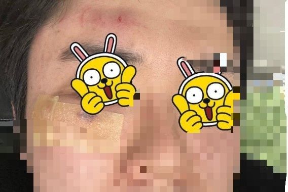 설 연휴 귀갓길에 다툼이 생겨 집단 폭행을 당했다는 사연이 전해졌다. (사진 출처 : 인터넷 커뮤니티 갈무리)