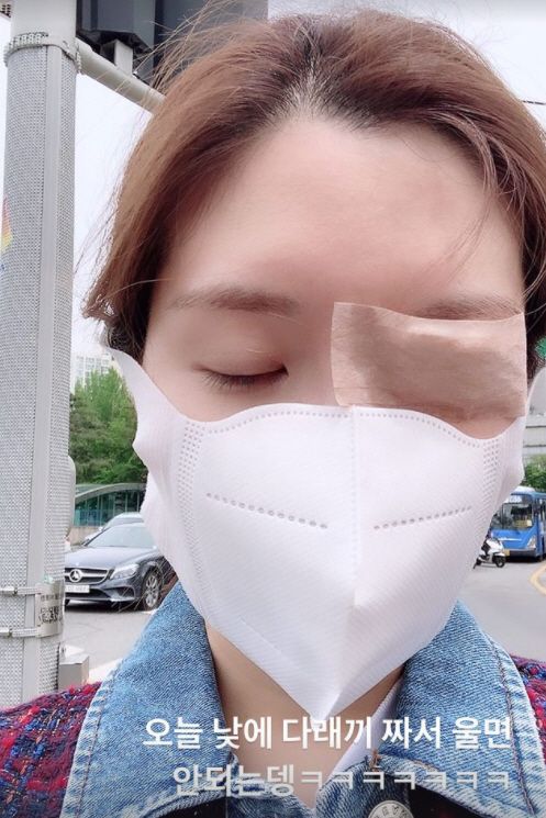 재벌도 못 피하는 눈 다래끼, 오뚜기 3세 함연지 ( 사진 출처 : 함연지 SNS )