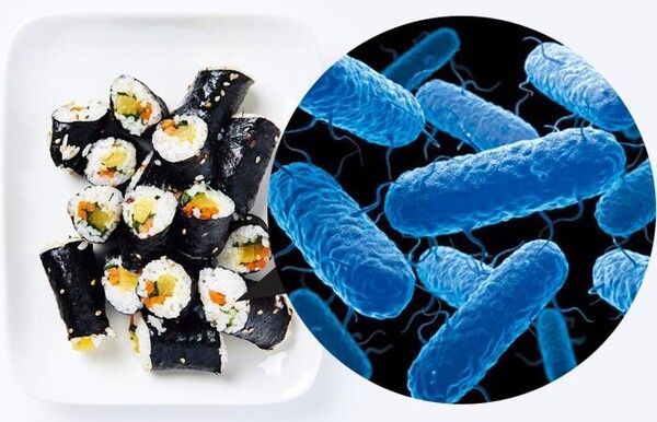 출처 : 커뮤니티