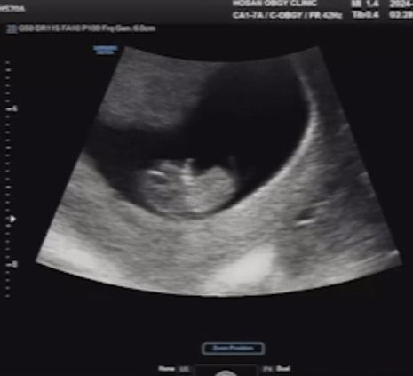 홍진호 인스타그램 갈무리