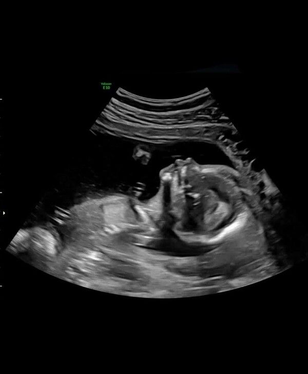 비와이 인스타그램