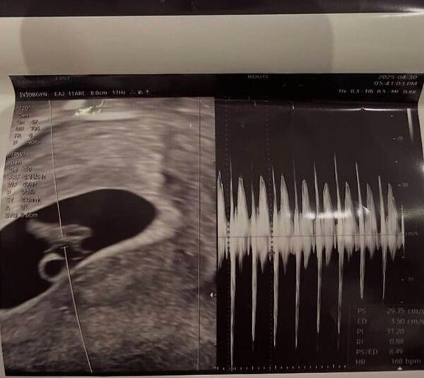 서민재 인스타그램