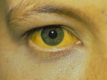 온라인커뮤니티