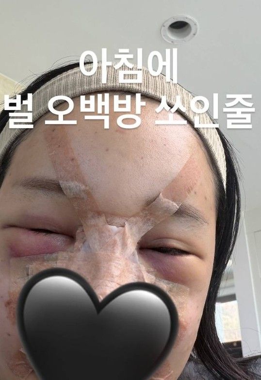 랄랄 인스타그램