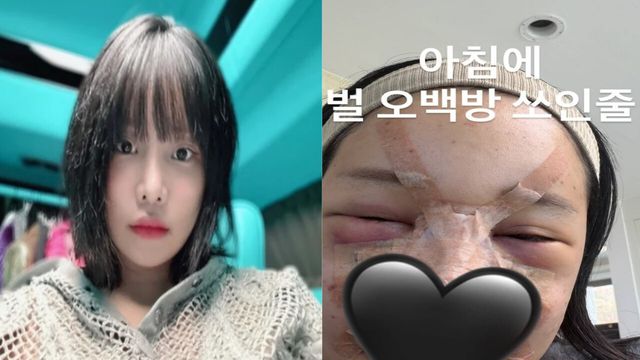 랄랄 인스타그램