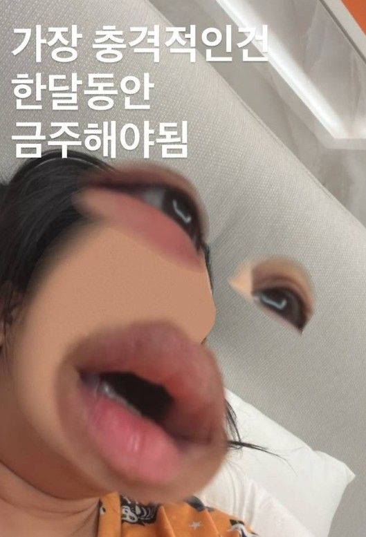 랄랄 인스타그램