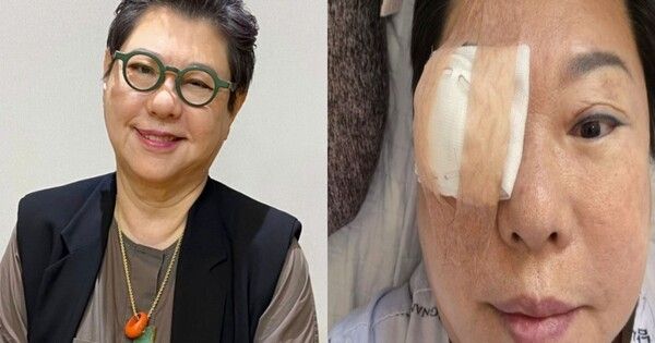 양희은 SNS