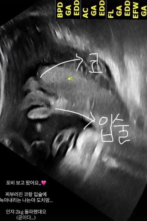 김지영 인스타그램