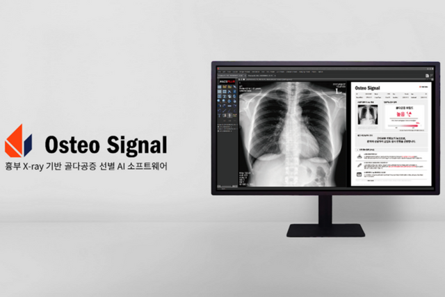 보건복지부 ‘평가 유예 신의료기술’로 선정된 Osteo Signal(오스테오 시그널). (사진=프로메디우스)