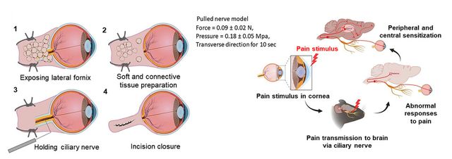 PN 모델의 외과적 절차. (사진=지스트)
