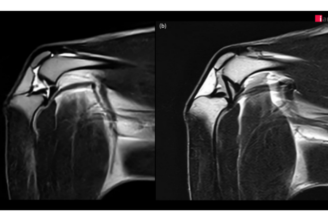 4kg 정상견의 전십자인대(a), 후십자인대(b). (사진=이안동물의학센터)
