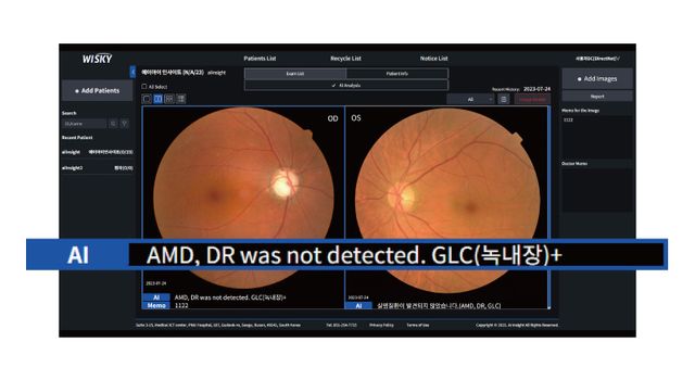 AI 실명질환 진단 보조 솔루션 ‘위스키(WISKY)'의 판독 이미지. (사진=아크)