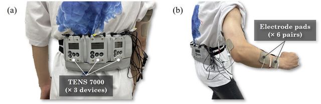 TelePulse EMS 장치 구성. (a) 세 개의 TENS 7000 기기를 허리에 장착하여 다채널 근육 자극을 구현함. (b) 총 6쌍의 전극 패드가 팔의 다양한 근육에 부착되어 정밀한 전기 자극을 제공함. (사진=지스트)