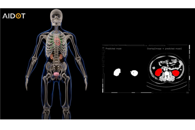 (사진=아이도트)