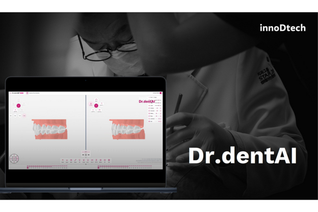 이노디테크 ‘닥터덴트AI’. (사진=이노디테크)