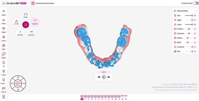 이노디테크 닥터덴트AI 시뮬레이션 서비스. (사진=이노디테크)