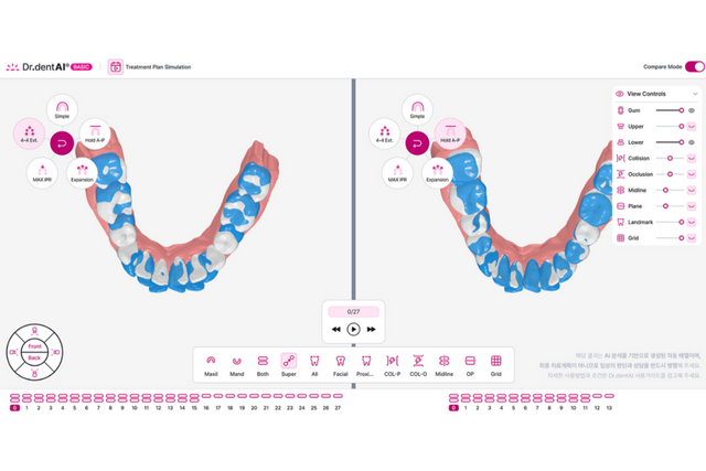 이노디테크 닥터덴트AI 시뮬레이션 서비스. (사진=이노디테크)