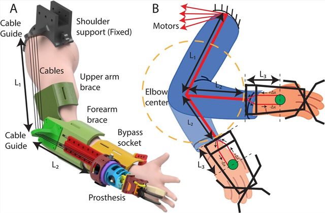 케이블 구동 기반 I-PEDLE 설계 및 전달 원리도. (사진=지스트)