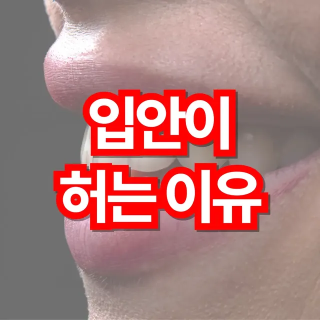 입안이-허는-이유