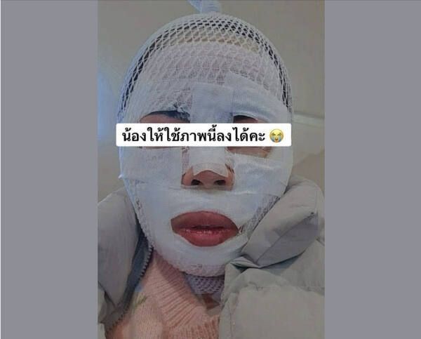 화상 입은 태국인 아내. 페이스북 캡처