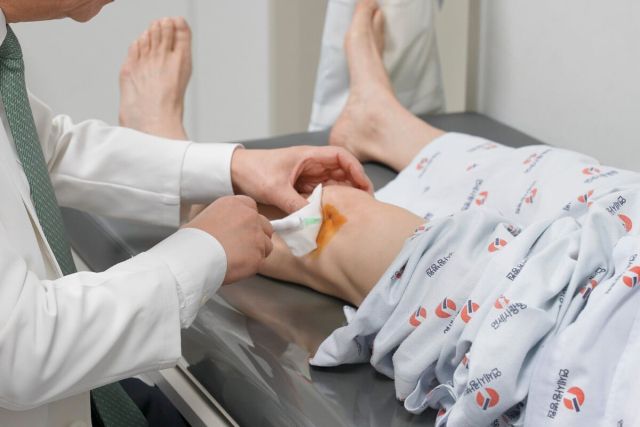 SVF 주사는 KL Grade 2-3기 환자의 관절기능을 개선하고 염증을 줄이는데 도움을 준다. 연세사랑병원