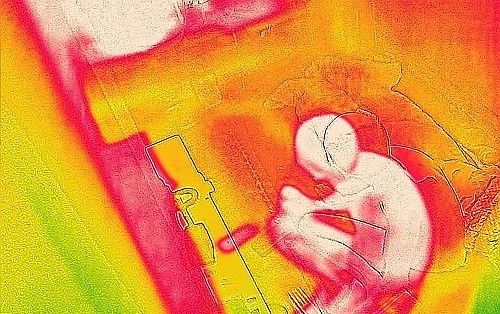 폭염이 이어진 2025년 7월 9일 서울의 한 쪽방촌을 열화상 카메라로 촬영한 모습. 연합뉴스